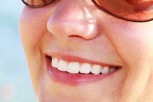 tooth whitening white teeth dentist spokane south hill washington